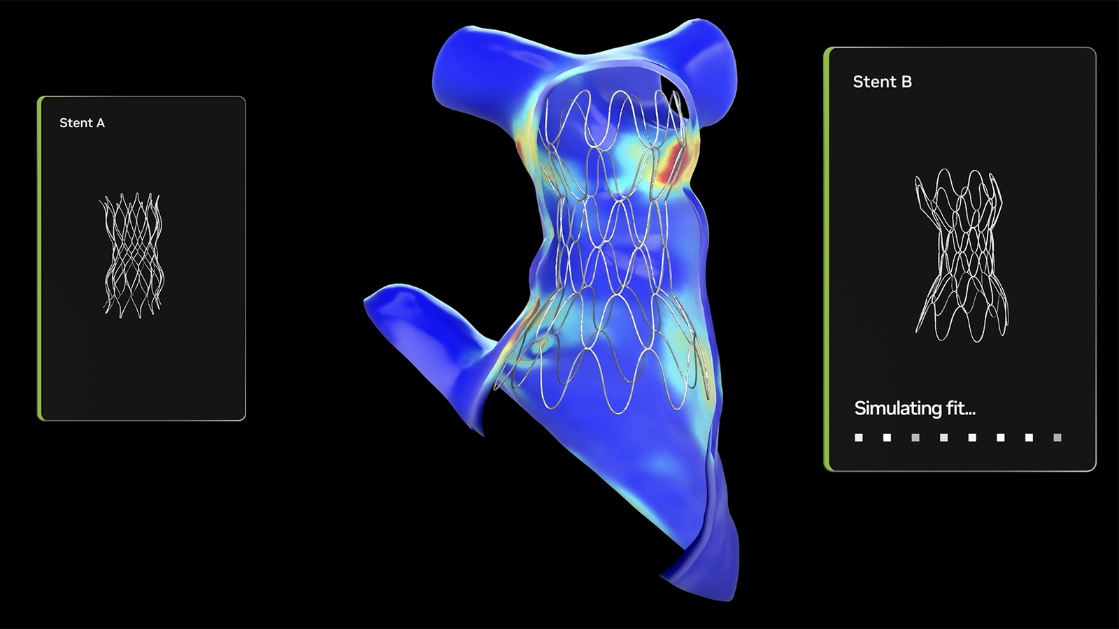 Hospital Infantil Usa IA Open Source da NVIDIA em Cuidados Cardíacos